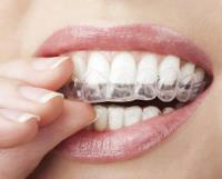 Melbourne Best Invisalign Treatment image 3